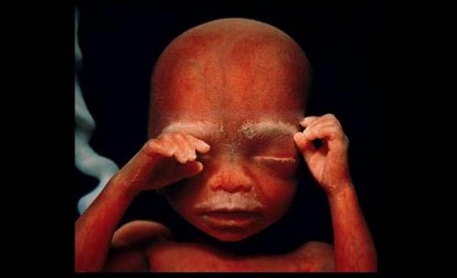 Série de fotos mostra como nasce um ser humano