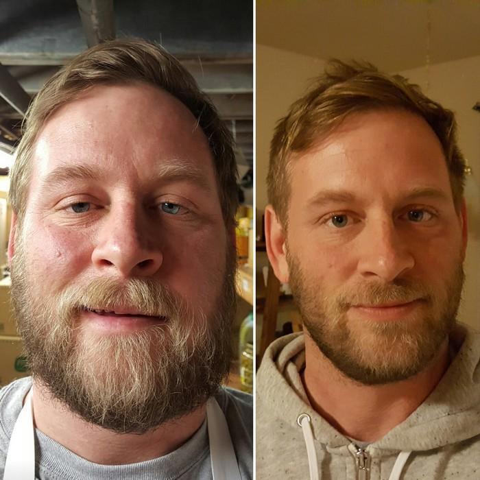 Uso De Alcool Antes E Depois